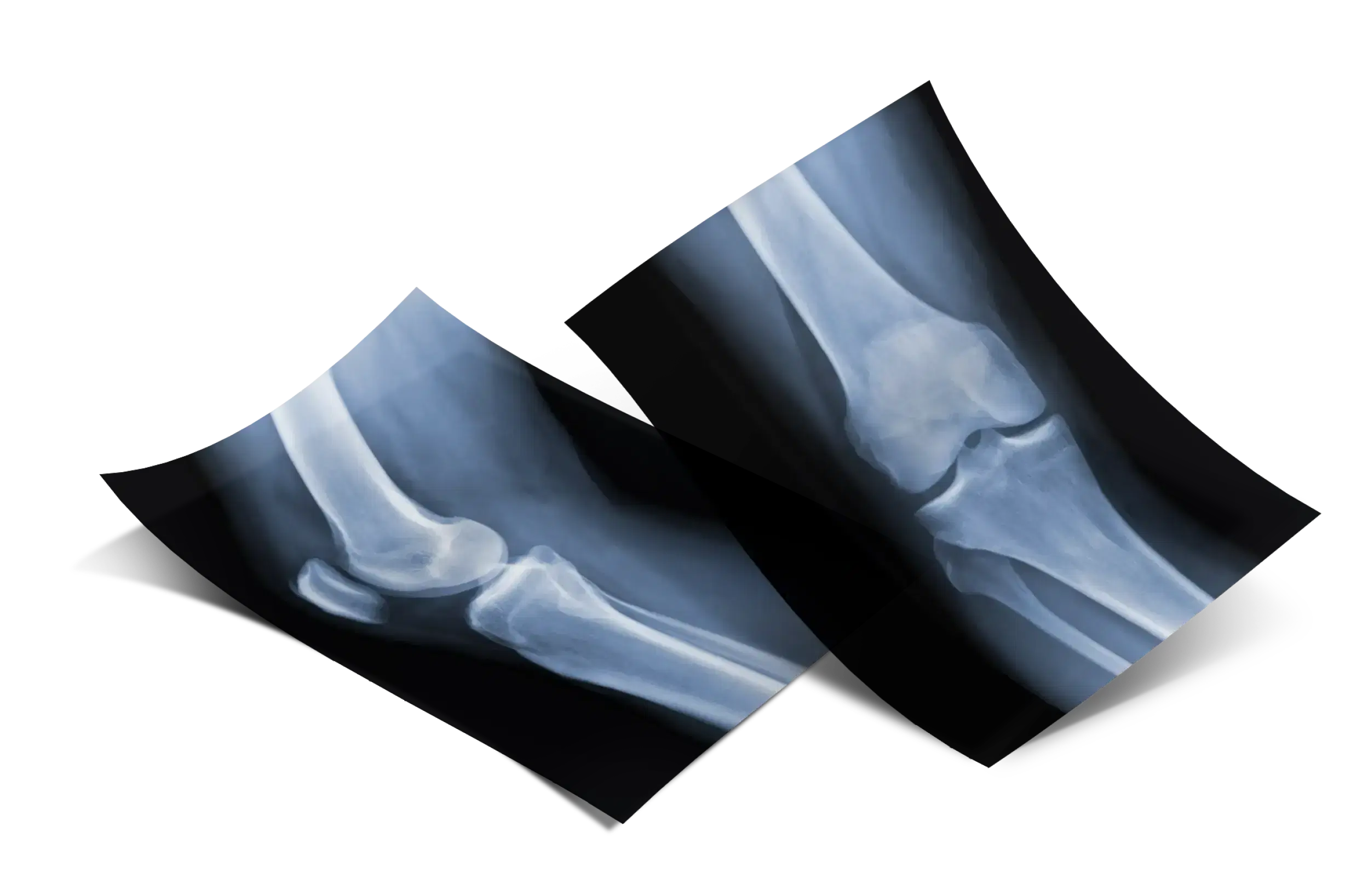 x rays image